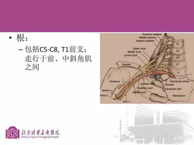 【PPT】臂丛的MR成像
