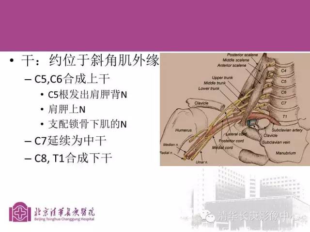 【PPT】臂丛的MR成像