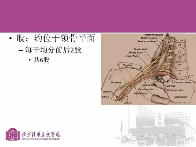 【PPT】臂丛的MR成像