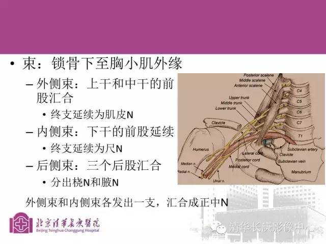 【PPT】臂丛的MR成像