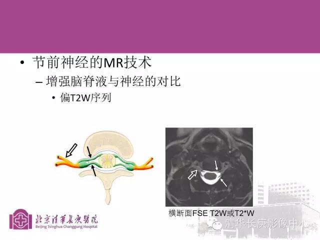 【PPT】臂丛的MR成像