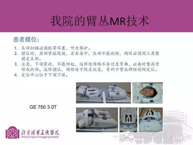【PPT】臂丛的MR成像