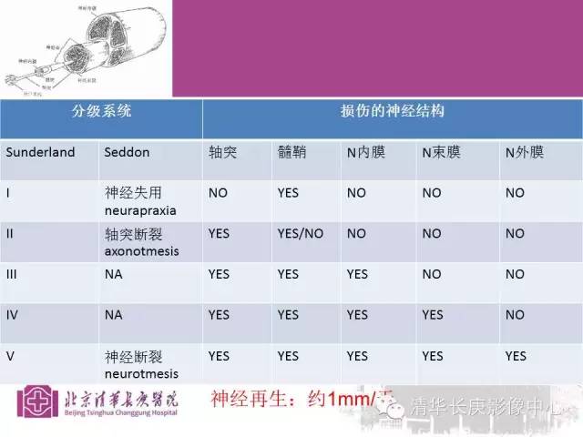 【PPT】臂丛的MR成像