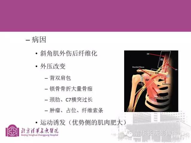 【PPT】臂丛的MR成像