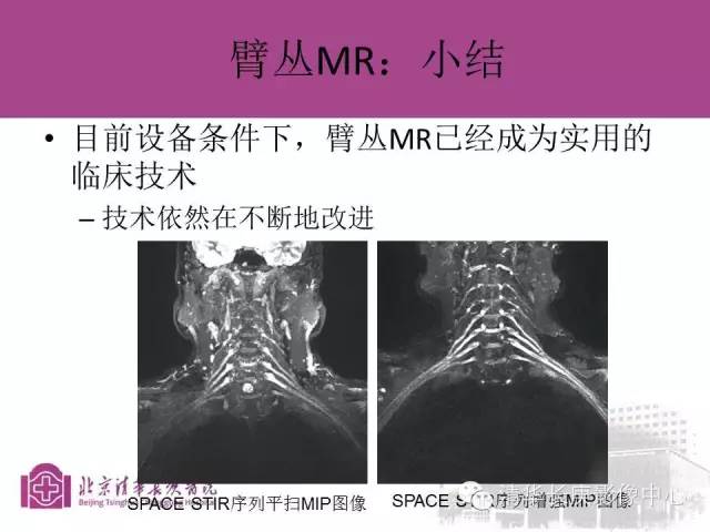 【PPT】臂丛的MR成像