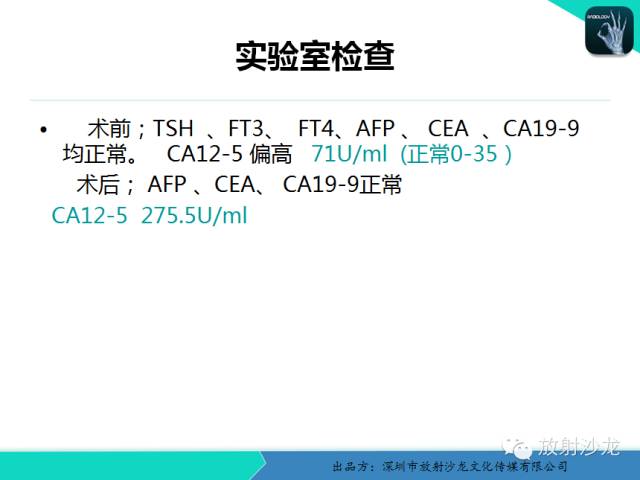 【病例】卵巢畸胎瘤1例MR影像诊断与鉴别
