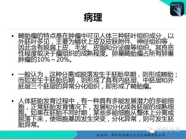 【病例】卵巢畸胎瘤1例MR影像诊断与鉴别