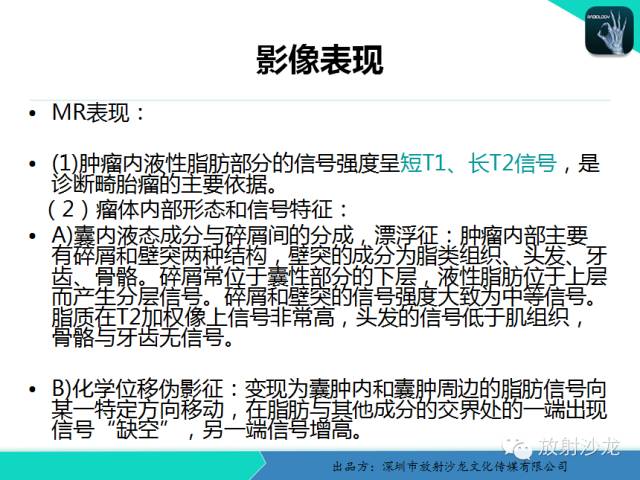 【病例】卵巢畸胎瘤1例MR影像诊断与鉴别