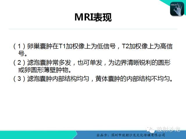 【病例】卵巢畸胎瘤1例MR影像诊断与鉴别