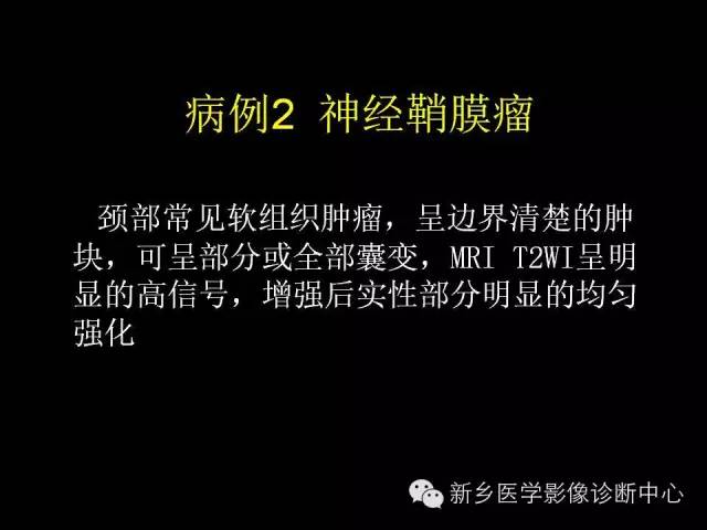 【病例】颈部囊性病变3例MR影像诊断与鉴别