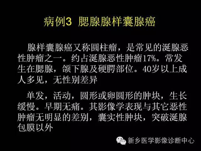【病例】颈部囊性病变3例MR影像诊断与鉴别