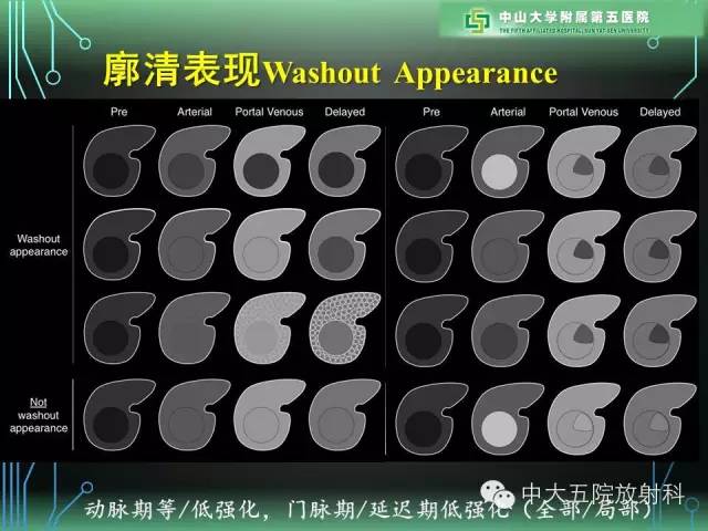 【PPT】肝癌高危患者肝脏结节影像学诊断