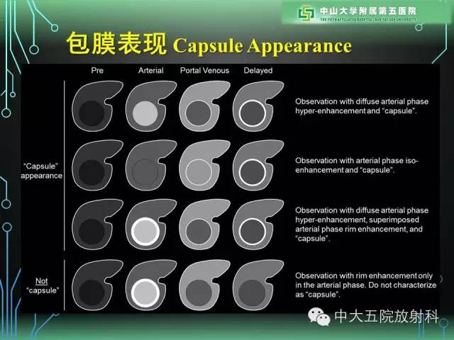 【PPT】肝癌高危患者肝脏结节影像学诊断