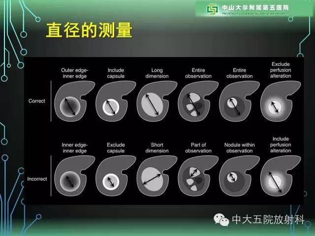 【PPT】肝癌高危患者肝脏结节影像学诊断