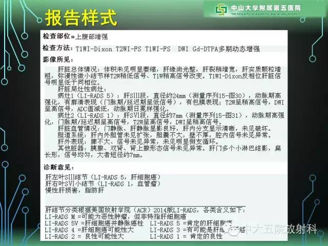【PPT】肝癌高危患者肝脏结节影像学诊断