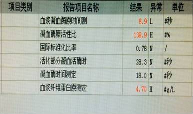 【病例】肿瘤样钙盐沉着症1例X线影像表现 【病例】肿瘤样钙盐沉着症1例X线影像表现