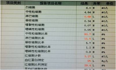 【病例】肿瘤样钙盐沉着症1例X线影像表现 【病例】肿瘤样钙盐沉着症1例X线影像表现
