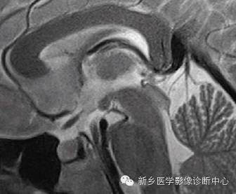 头部失状位解剖+详细标注