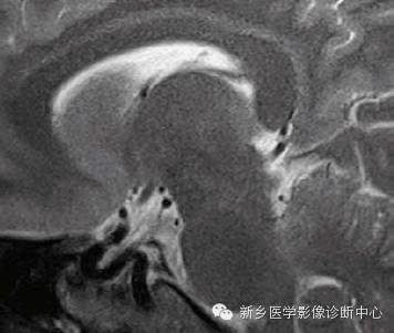 头部失状位解剖+详细标注