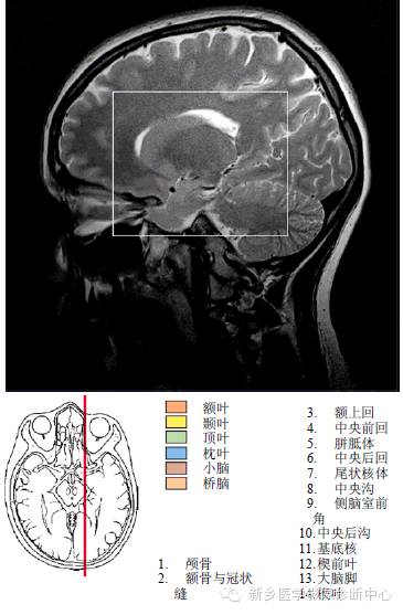 头部失状位解剖+详细标注