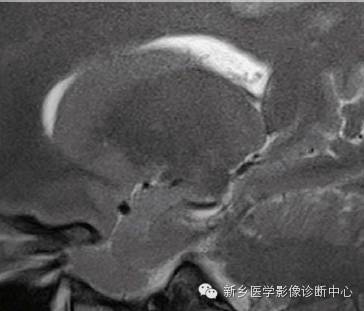 头部失状位解剖+详细标注