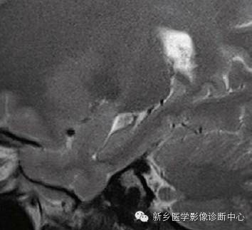 头部失状位解剖+详细标注