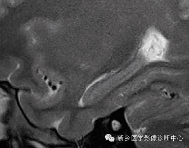 头部失状位解剖+详细标注