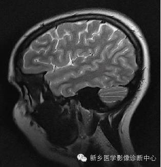 头部失状位解剖+详细标注