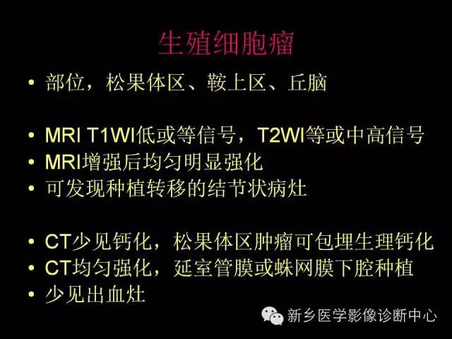 【病例】丘脑生殖细胞瘤1例MR影像表现