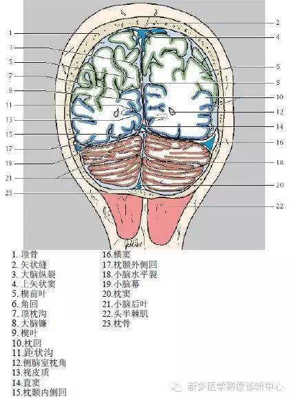 头部冠状位解剖+详细标注