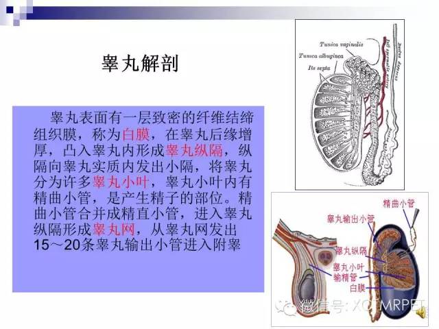 【PPT】睾丸生殖细胞肿瘤的磁共振诊断