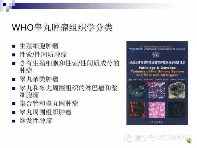 【PPT】睾丸生殖细胞肿瘤的磁共振诊断