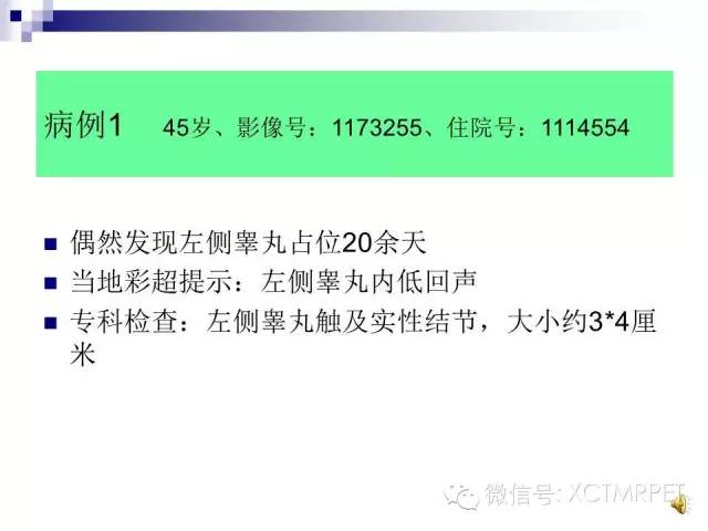 【PPT】睾丸生殖细胞肿瘤的磁共振诊断