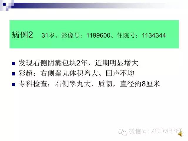 【PPT】睾丸生殖细胞肿瘤的磁共振诊断
