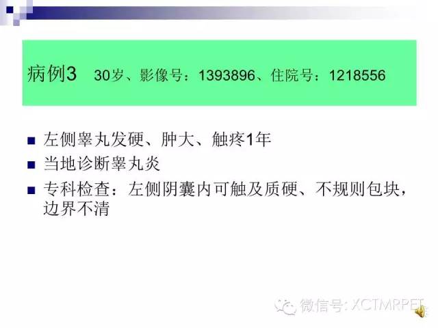【PPT】睾丸生殖细胞肿瘤的磁共振诊断