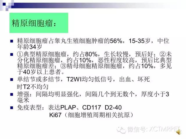 【PPT】睾丸生殖细胞肿瘤的磁共振诊断