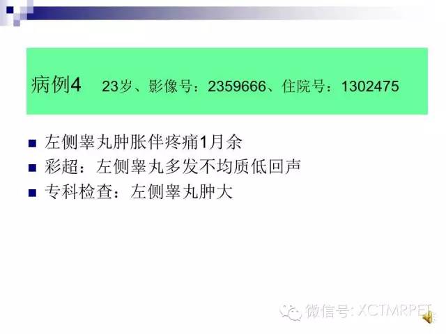 【PPT】睾丸生殖细胞肿瘤的磁共振诊断