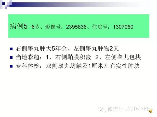 【PPT】睾丸生殖细胞肿瘤的磁共振诊断