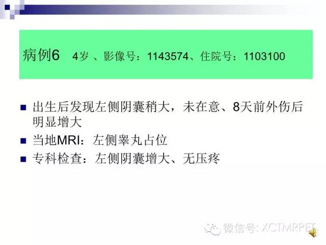 【PPT】睾丸生殖细胞肿瘤的磁共振诊断