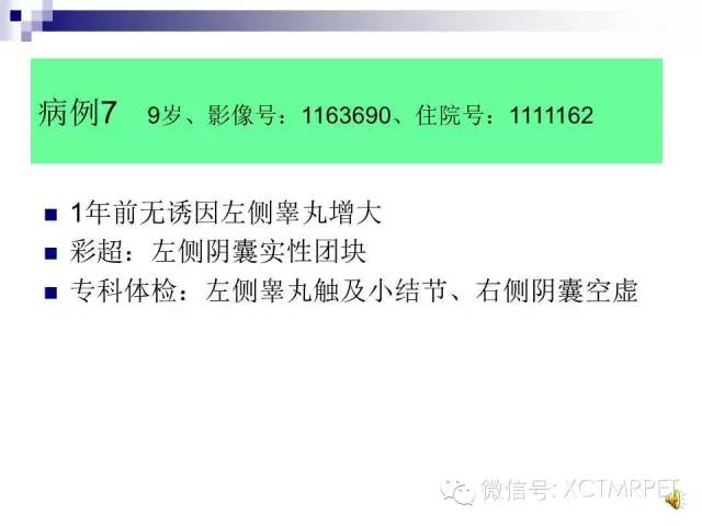 【PPT】睾丸生殖细胞肿瘤的磁共振诊断