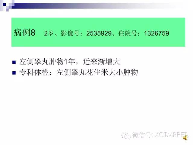 【PPT】睾丸生殖细胞肿瘤的磁共振诊断