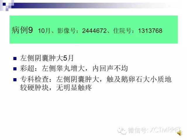 【PPT】睾丸生殖细胞肿瘤的磁共振诊断