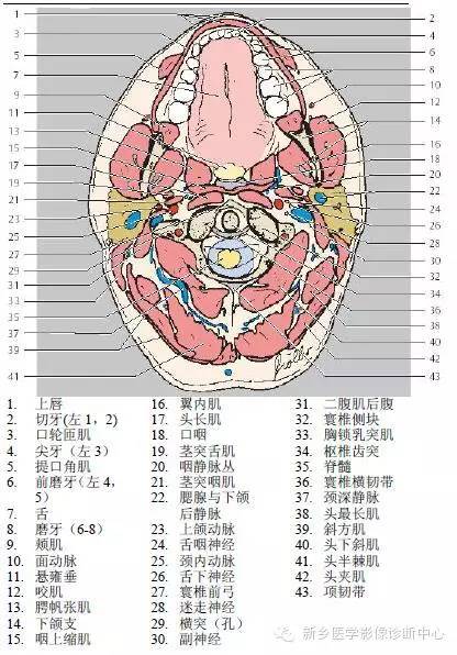 颈部精细横断位解剖+详细标注