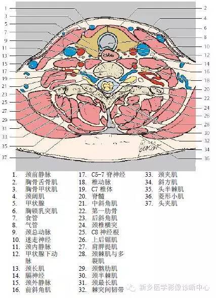 颈部精细横断位解剖+详细标注