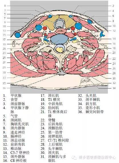 颈部精细横断位解剖+详细标注