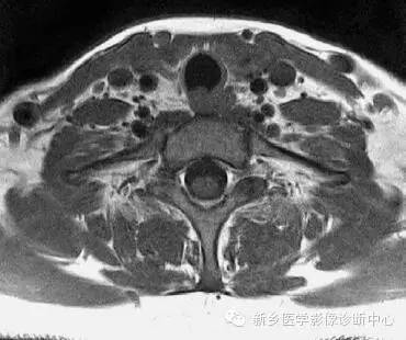 颈部精细横断位解剖+详细标注