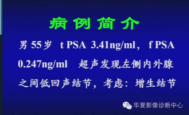 DWI序列之：在前列腺癌中的应用