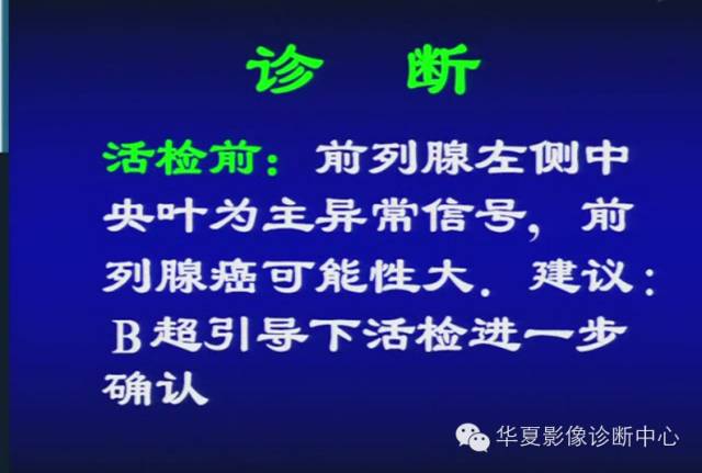 DWI序列之：在前列腺癌中的应用