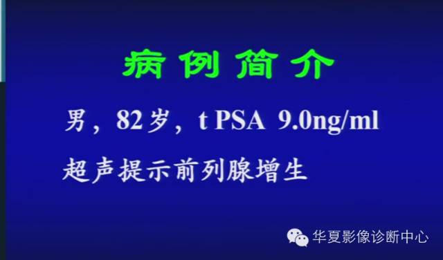 DWI序列之：在前列腺癌中的应用