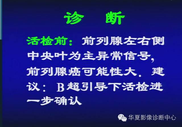 DWI序列之：在前列腺癌中的应用